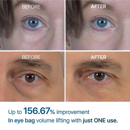 كريم Dr Melaxin Eyephalt لمعالجة أكياس تحت العين