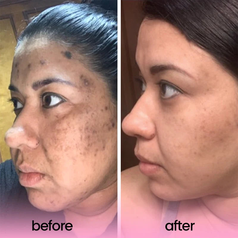 Kojic Acid Turmeric Cleaning Pads