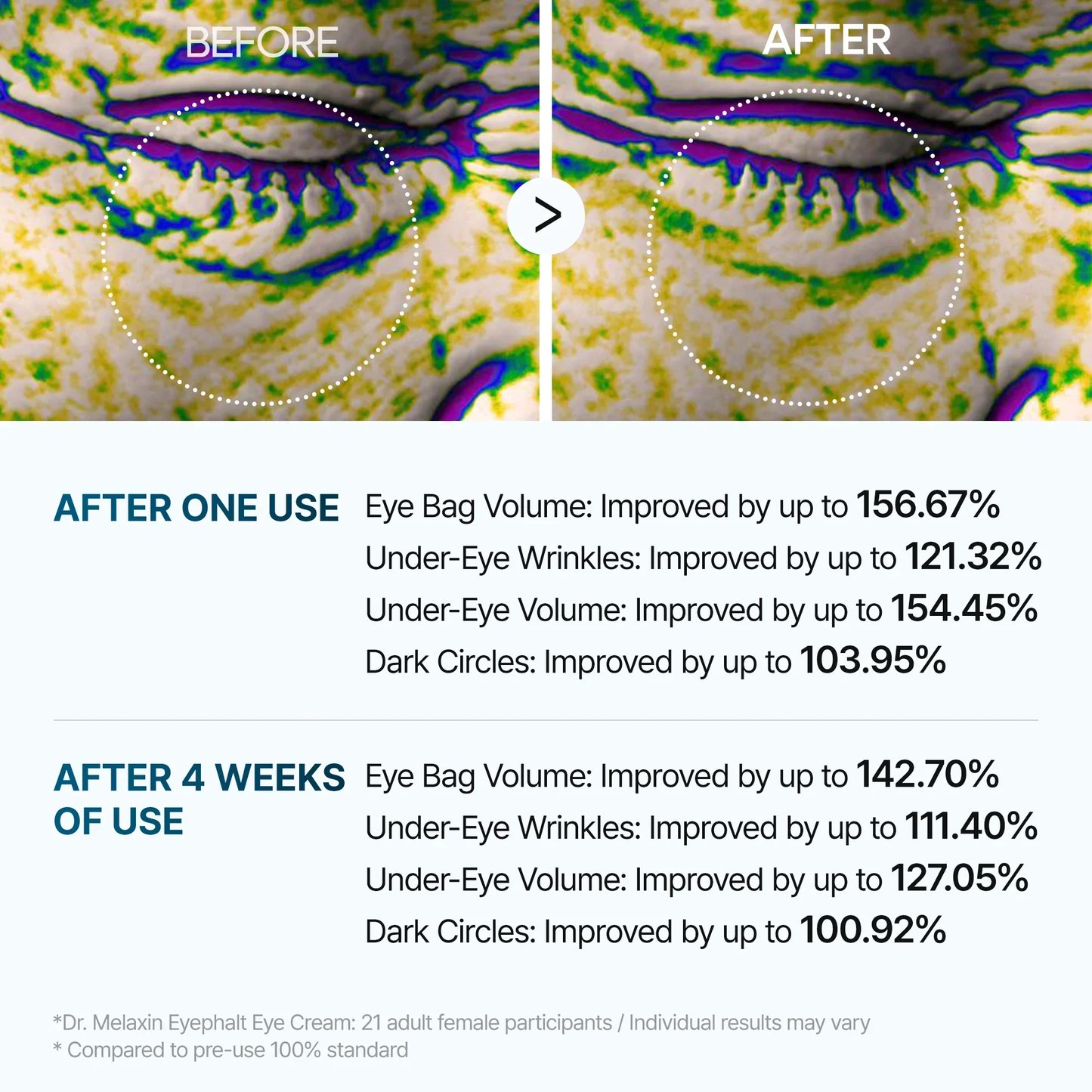 كريم Dr Melaxin Eyephalt لمعالجة أكياس تحت العين